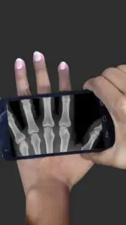 X Ray Scanner Pro captura 2