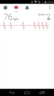 Cardiograph captura 4
