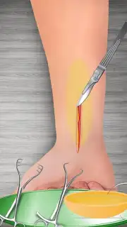 WristSurgeryDoctor captura 10