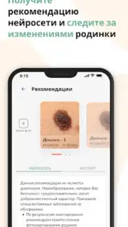 Про родинки captura 5