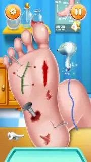 Foot Surgery Doctor Care captura 10