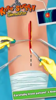 KneeSurgery captura 2