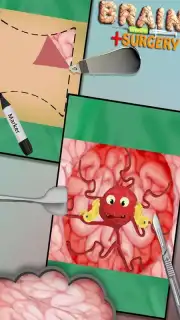 BrainSurgery captura 2